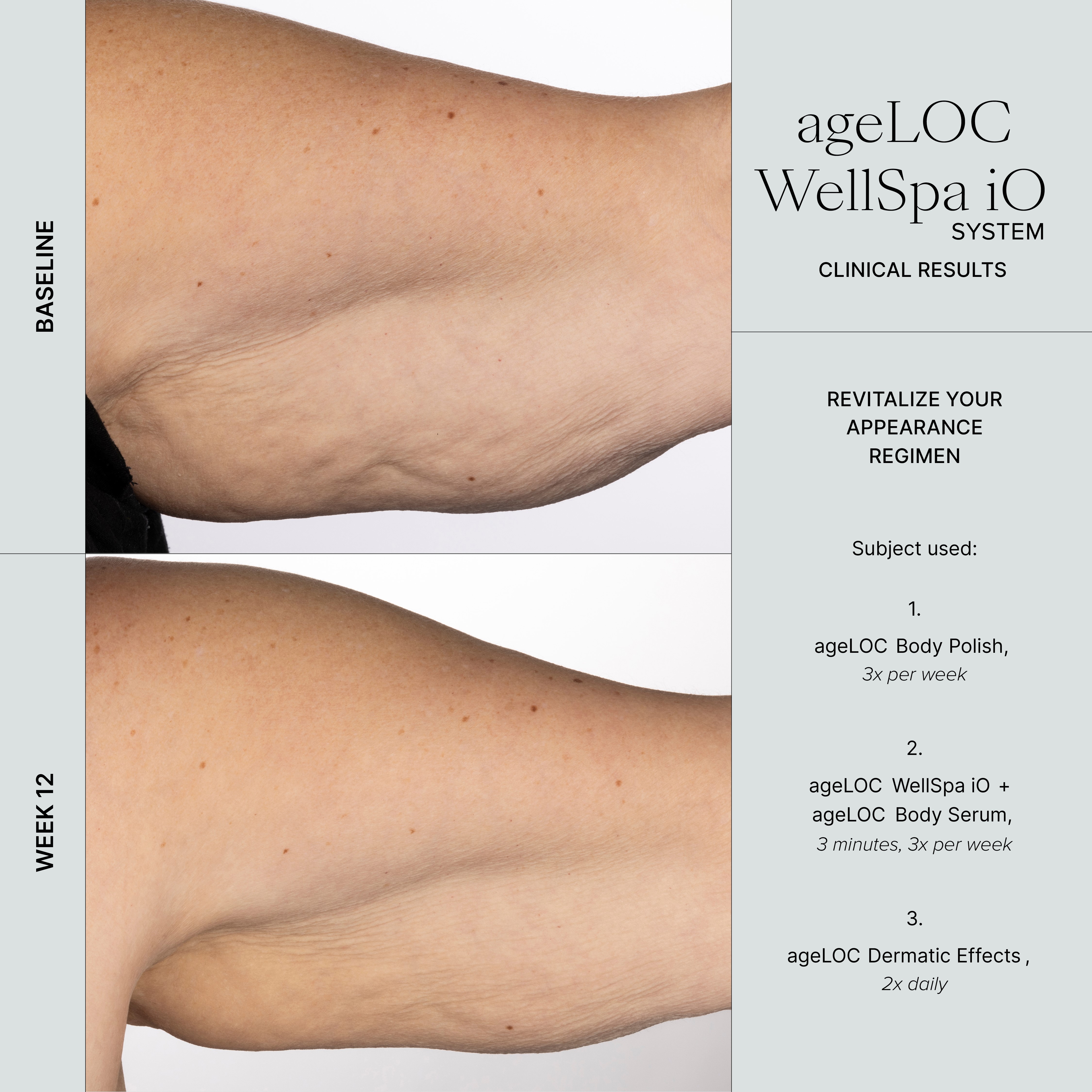 WellSpa iO before after 3min 3x arm